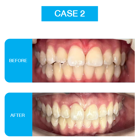 Website CS-02-11